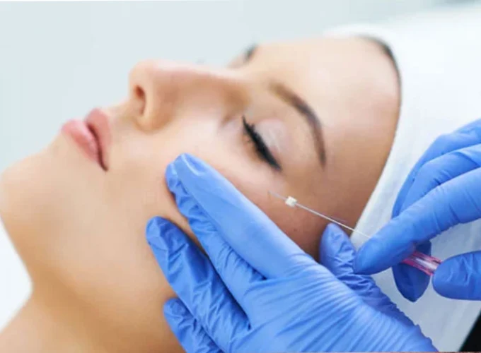 Thread Lift Treatment in Gurgaon