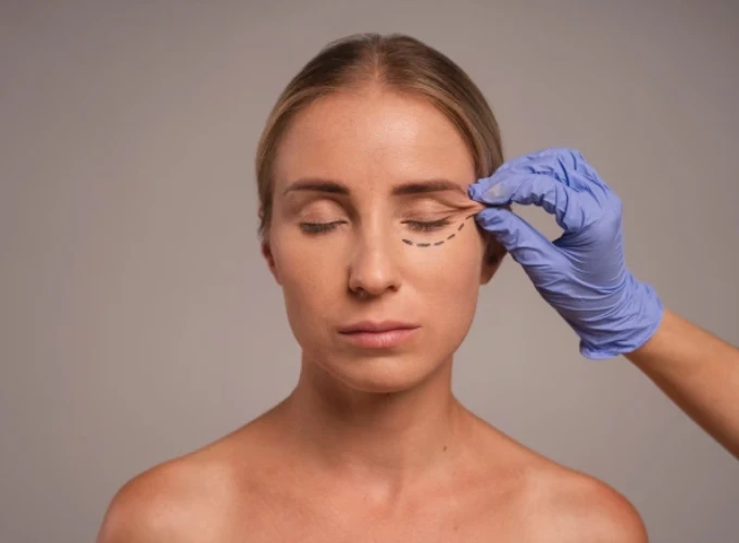 Aptos Thread Lift Treatment in Gurgaon