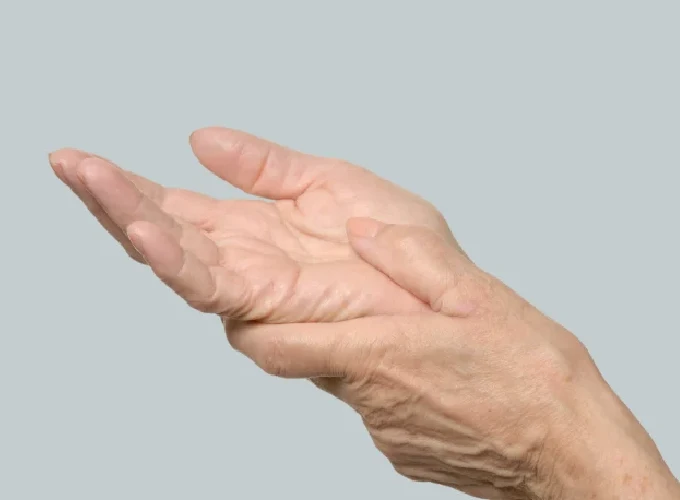 Ageing Hands and Feet Treatment in Gurgaon