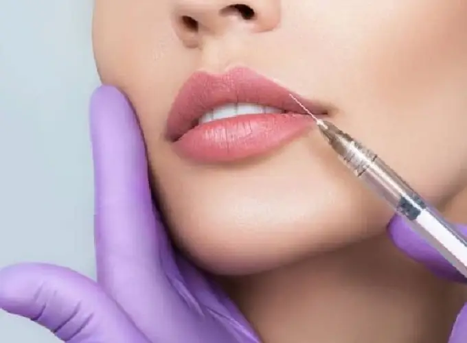 Dermal Fillers Treatment in Delhi