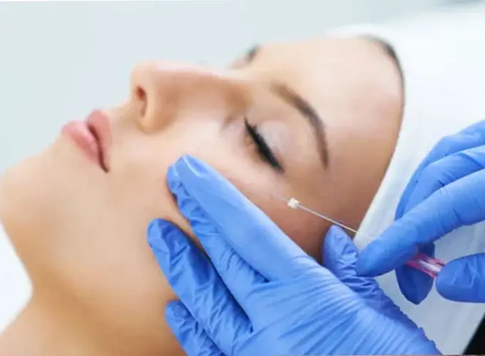 Threadlift Treatment in Delhi