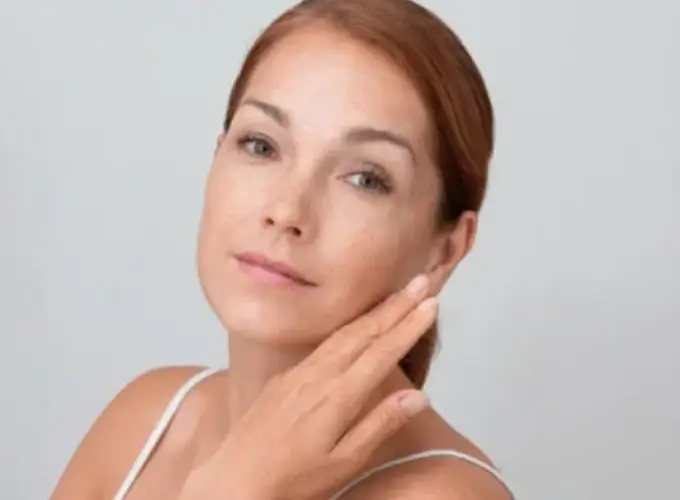 Melasma Treatment in Delhi