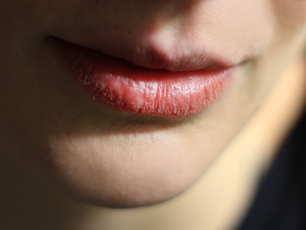 Dry lips