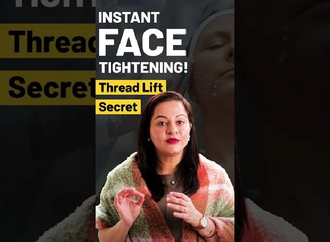 What is Thread Lift Treatment?