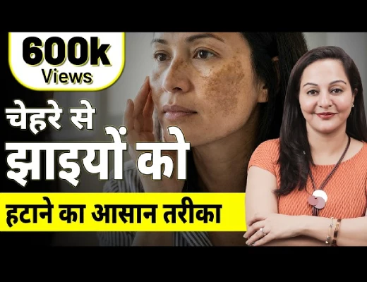 What is Pigmentation?