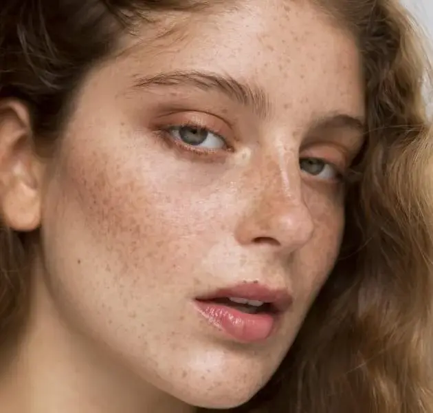 UNEVEN SKIN TONE