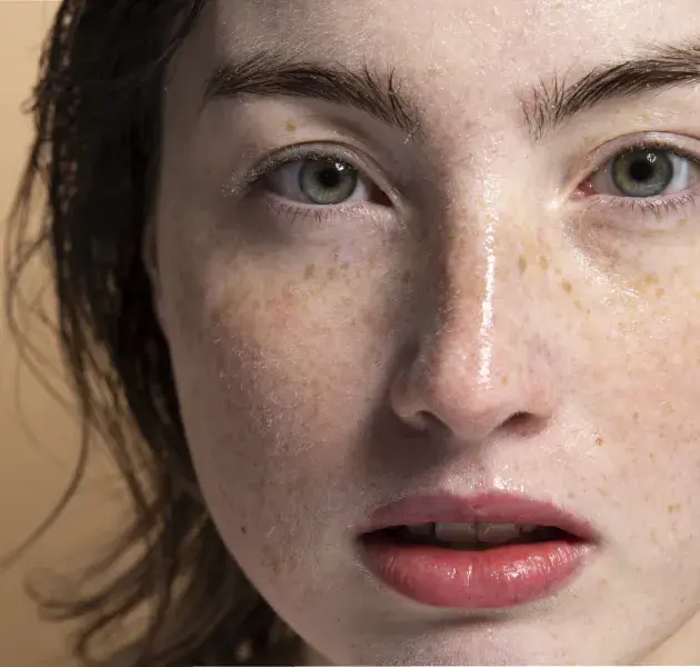 DRUG-INDUCED MELANOSIS