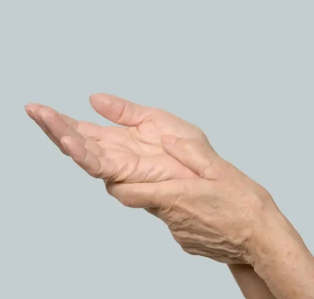 AGEING HANDS AND FEET