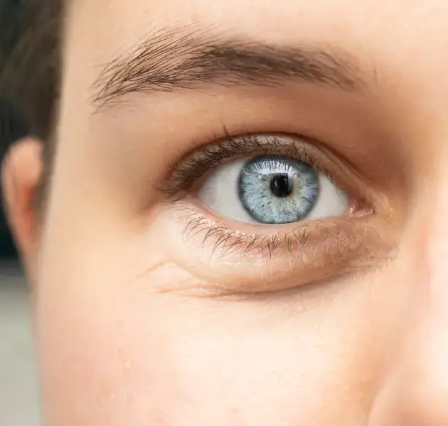 UNDER EYE PUFFINESS