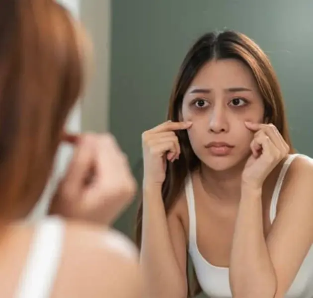 DARK CIRCLES