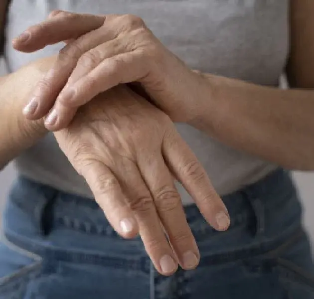 DRY AND WRINKLED HANDS