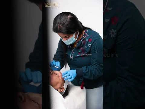 Semi-Permanent Eyebrow Setting | Natural, Long-Lasting Brows at Citrine Clinic